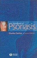 bokomslag Handbook of Psoriasis
