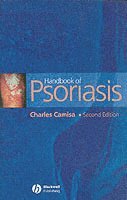 Handbook of Psoriasis 1