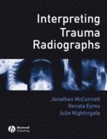 bokomslag Interpreting Trauma Radiographs