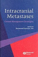 Intracranial Metastases 1