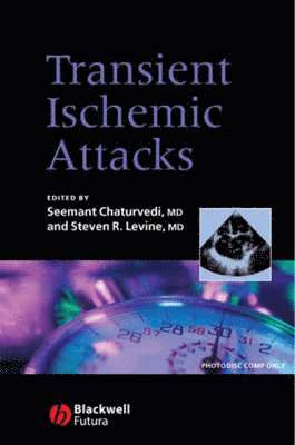 Seemant Chaturvedi, Steven R. Levine - Transient Ischemic Attacks, Inbunden