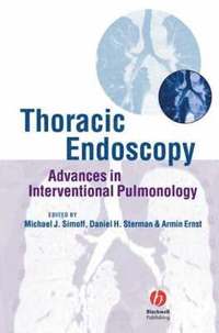 bokomslag Thoracic Endoscopy