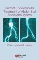 bokomslag Current Endovascular Treatment of Abdominal Aortic Aneurysms