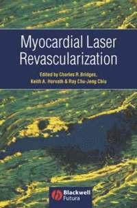 bokomslag Myocardial Laser Revascularization
