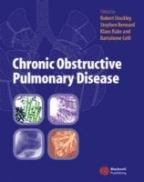 Robert A. Stockley, Stephen I Rennard, Klaus Rabe, Bartolome Celli - Chronic Obstructive Pulmonary Disease, Inbunden