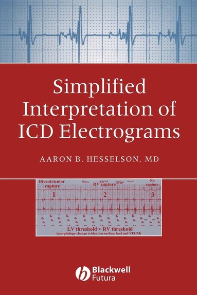 bokomslag Simplified Interpretation of ICD Electrograms