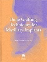 Bone Grafting Techniques for Maxillary Implants
