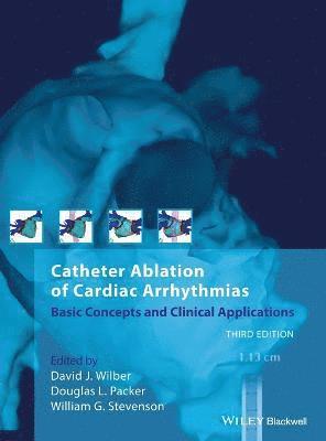 David J. Wilber, Douglas L. Packer, William G. Stevenson - Catheter Ablation of Cardiac Arrhythmias, Inbunden