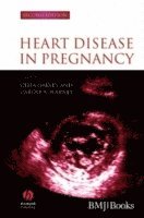 bokomslag Heart Disease in Pregnancy