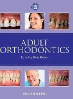 bokomslag Adult Orthodontics