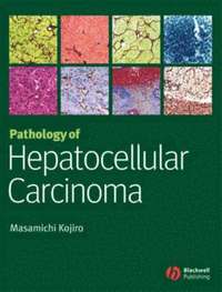 bokomslag Pathology of Hepatocellular Carcinoma