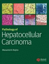 bokomslag Pathology of Hepatocellular Carcinoma