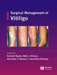 bokomslag Surgical Management of Vitiligo