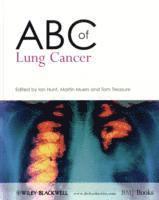 bokomslag ABC of Lung Cancer