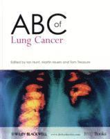 Ian Hunt, Martin M. Muers, Tom Treasure - ABC of Lung Cancer, Häftad