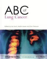 ABC of Lung Cancer 1