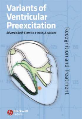 Variants of Ventricular Preexcitation 1