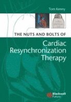 bokomslag The Nuts and Bolts of Cardiac Resynchronization Therapy
