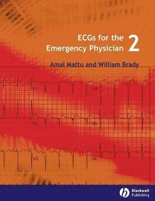 ECGs for the Emergency Physician 2 1