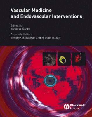 bokomslag Vascular Medicine and Endovascular Interventions