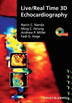 bokomslag Live/Real Time 3D Echocardiography