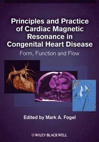 bokomslag Principles and Practice of Cardiac Magnetic Resonance in Congenital Heart Disease