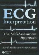 ECG Interpretation