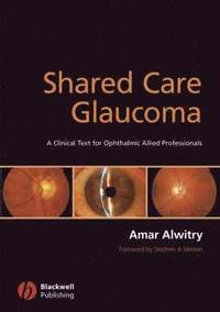bokomslag Shared Care Glaucoma