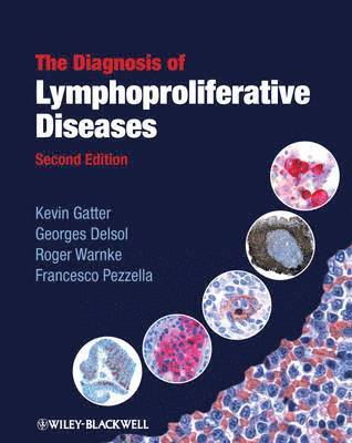 bokomslag The Diagnosis of Lymphoproliferative Diseases