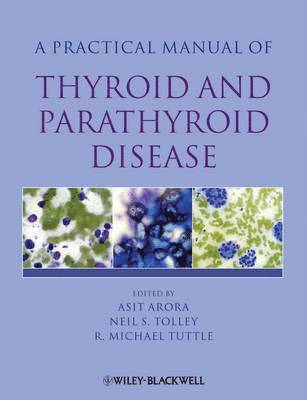 Editor:Asit Arora, Editor:Neil Tolley, Editor:R. Tuttle, Asit Arora, Neil Tolley, R. Michael Tuttle, UK) Arora, Asit (St Mary's Hospital, London, UK) Tolley, Neil (St Mary's Hospital, London, USA) Tuttle, R. Michael (Memorial Sloan-Kettering Cancer Center, New York, NY, R Michael Tuttle - Practical Manual of Thyroid and Parathyroid Disease, Inbunden
