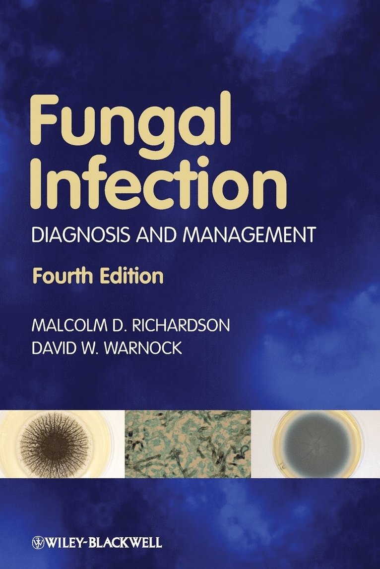 Malcolm D. Richardson, David W. Warnock, Richardson, Malcolm D Richardson, David W Warnock - Fungal Infection, Häftad