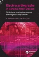 bokomslag Electrocardiography in Ischemic Heart Disease