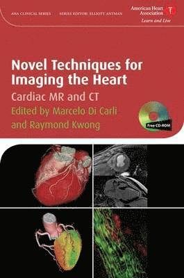 Marcelo F. Di Carli, Raymond Y. Kwong, Marcelo F. (Brigham and Women's Hospital) Di Carli, Raymond Y. (Harvard Medical School) Kwong, Marcelo F Di Carli, Raymond Y Kwong - Novel Techniques for Imaging the Heart, Inbunden