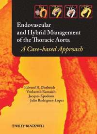 bokomslag Endovascular and Hybrid Management of the Thoracic Aorta