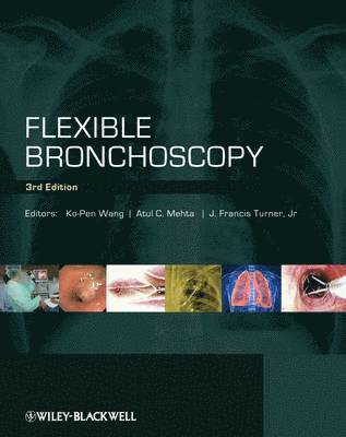 bokomslag Flexible Bronchoscopy