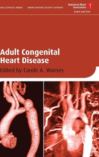 bokomslag Adult Congenital Heart Disease