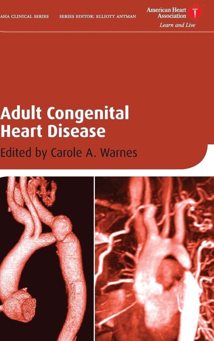 Adult Congenital Heart Disease 1