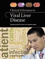 bokomslag Clinical Dilemmas in Viral Liver Disease