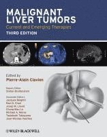 bokomslag Malignant Liver Tumors