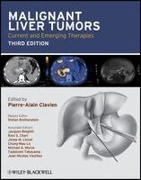 Pierre-Alain Clavien - Malignant Liver Tumors, Inbunden