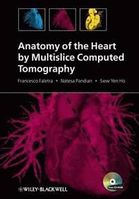 bokomslag Anatomy of the Heart by Multislice Computed Tomography