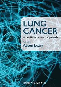 bokomslag Lung Cancer