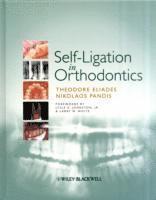 bokomslag Self-Ligation in Orthodontics