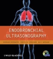 bokomslag Endobronchial Ultrasonography
