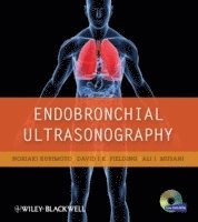 Endobronchial Ultrasonography 1