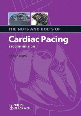 Tom Kenny, Texas) Kenny, Tom (St. Jude Medical, Austin, Kenny - Nuts and Bolts of Cardiac Pacing, Häftad
