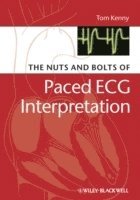 Tom Kenny, Texas) Kenny, Tom (St. Jude Medical, Austin - Nuts and bolts of Paced ECG Interpretation, Häftad