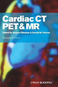 bokomslag Cardiac CT, PET and MR