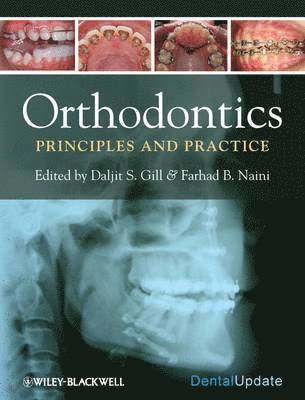 Daljit S. Gill, Farhad B. Naini - Orthodontics, Inbunden