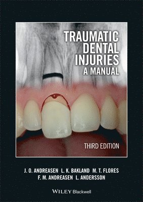 bokomslag Traumatic Dental Injuries